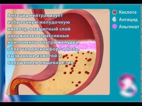 Видео о препарате Гавискон Форте мятная сусп, сашетки 10мл №20