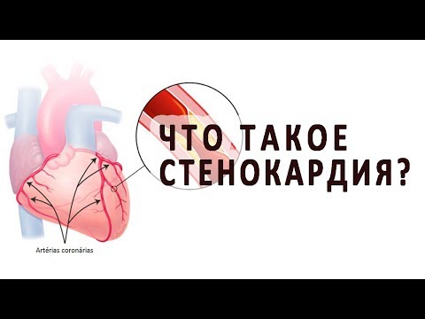Видео о препарате Депонит 10 Нитродерм пластырь №15